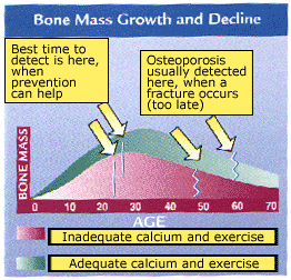 Osteoporosis